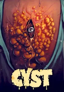 Cyst